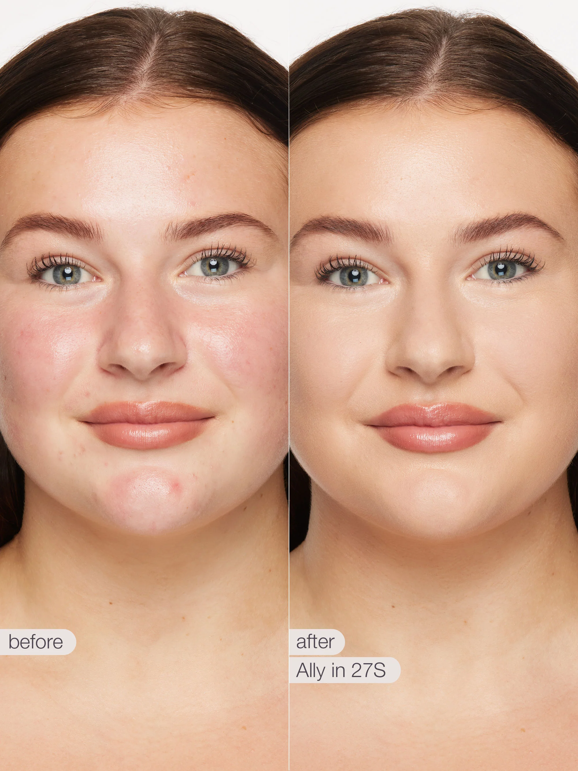 Product image 100